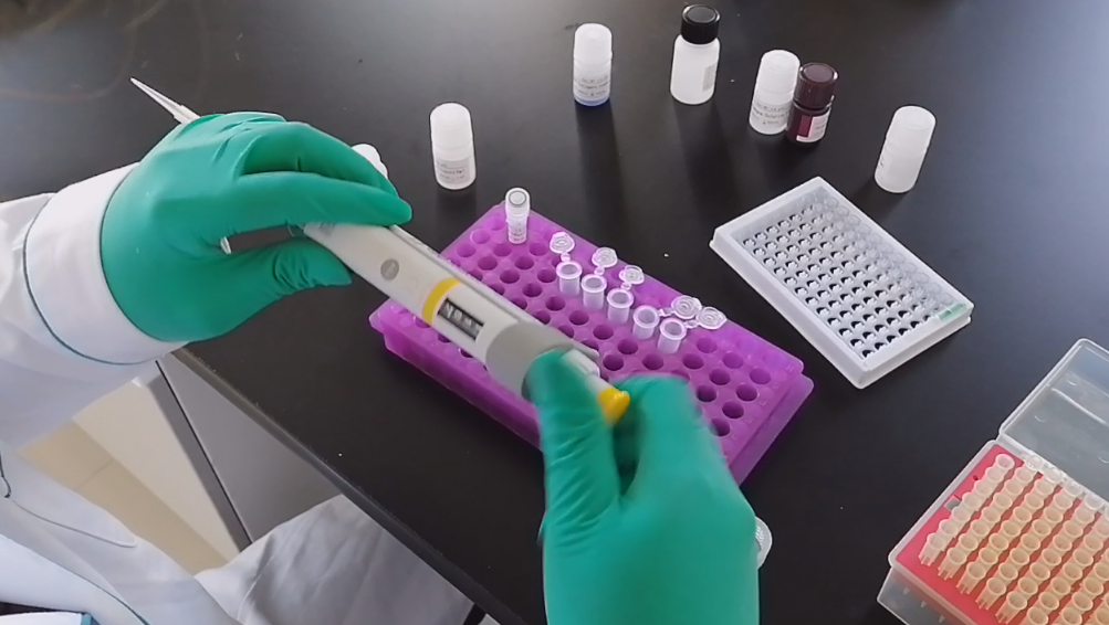 ELISA試劑盒 抗體 血清 抗原 試劑 本生試劑盒